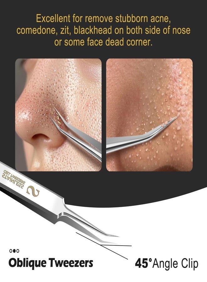 WSYUB Professional Blackhead Tweezers, Blackhead Remover Tools,Ingrown Hair Removal Kit - Image 4